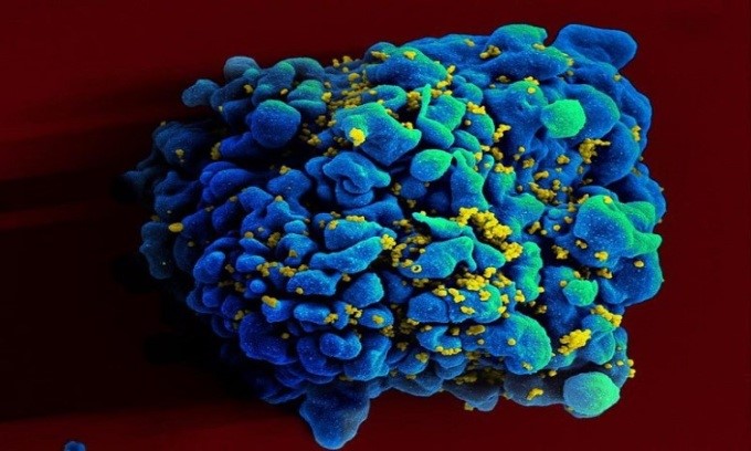 Vaccine mRNA ngăn HIV thử nghiệm an toàn, cho kết quả tốt trên động vật